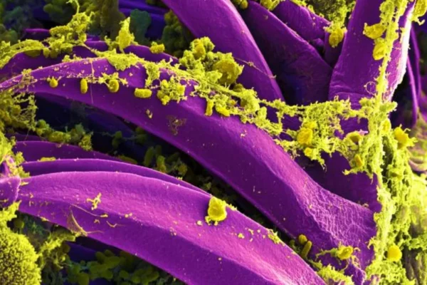 Scanning electron micrograph of Yersinia pestis, which causes bubonic plague, on proventricular spines of a Xenopsylla cheopis flea National Institute of Allergy and Infectious Diseases (NIAID)